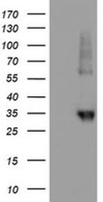 NPTN Antibody in Western Blot (WB)