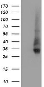 NPTN Antibody in Western Blot (WB)