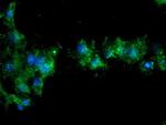 NQO2 Antibody in Immunocytochemistry (ICC/IF)