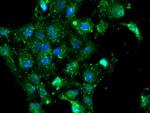 NQO2 Antibody in Immunocytochemistry (ICC/IF)