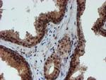 NQO2 Antibody in Immunohistochemistry (Paraffin) (IHC (P))