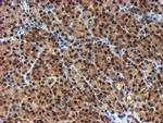 NQO2 Antibody in Immunohistochemistry (Paraffin) (IHC (P))