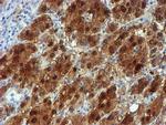 NQO2 Antibody in Immunohistochemistry (Paraffin) (IHC (P))