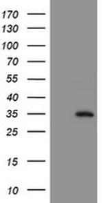 NQO2 Antibody in Western Blot (WB)