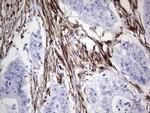 NR0B1 Antibody in Immunohistochemistry (Paraffin) (IHC (P))