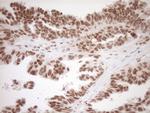 NR1H3 Antibody in Immunohistochemistry (Paraffin) (IHC (P))