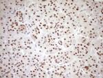 NR1H3 Antibody in Immunohistochemistry (Paraffin) (IHC (P))