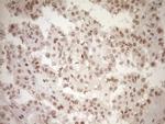 NR1H3 Antibody in Immunohistochemistry (Paraffin) (IHC (P))