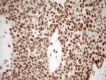 NR1H3 Antibody in Immunohistochemistry (Paraffin) (IHC (P))