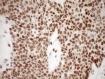 NR1H3 Antibody in Immunohistochemistry (Paraffin) (IHC (P))