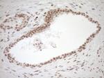 NR1H3 Antibody in Immunohistochemistry (Paraffin) (IHC (P))