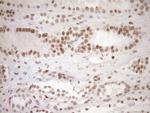 NR1H3 Antibody in Immunohistochemistry (Paraffin) (IHC (P))