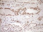 NR1H3 Antibody in Immunohistochemistry (Paraffin) (IHC (P))