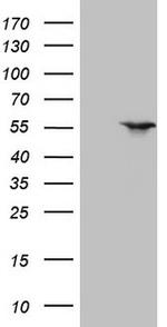 NR1H3 Antibody in Western Blot (WB)