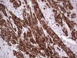 NR1I3 Antibody in Immunohistochemistry (Paraffin) (IHC (P))