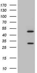 NR1I3 Antibody in Western Blot (WB)