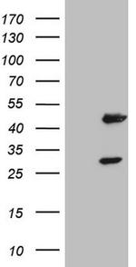 NR1I3 Antibody in Western Blot (WB)