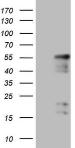 NR2E3 Antibody in Western Blot (WB)