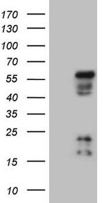 NR2E3 Antibody in Western Blot (WB)