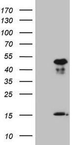 NR2E3 Antibody in Western Blot (WB)