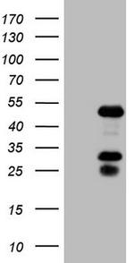 NR2F6 Antibody in Western Blot (WB)