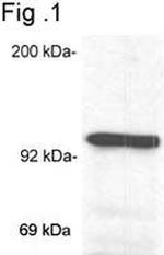 Glucocorticoid Receptor Antibody in Western Blot (WB)