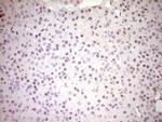 NR3C1 Antibody in Immunohistochemistry (Paraffin) (IHC (P))