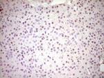 NR3C1 Antibody in Immunohistochemistry (Paraffin) (IHC (P))