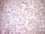 NR3C1 Antibody in Immunohistochemistry (Paraffin) (IHC (P))