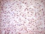 NR3C1 Antibody in Immunohistochemistry (Paraffin) (IHC (P))