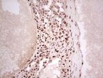 NR3C1 Antibody in Immunohistochemistry (Paraffin) (IHC (P))