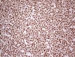 NR3C1 Antibody in Immunohistochemistry (Paraffin) (IHC (P))