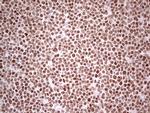 NR3C1 Antibody in Immunohistochemistry (Paraffin) (IHC (P))