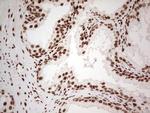 NR3C1 Antibody in Immunohistochemistry (Paraffin) (IHC (P))