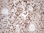 NR3C1 Antibody in Immunohistochemistry (Paraffin) (IHC (P))