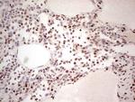 NR3C1 Antibody in Immunohistochemistry (Paraffin) (IHC (P))