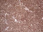 NR3C1 Antibody in Immunohistochemistry (Paraffin) (IHC (P))