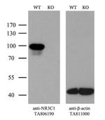 NR3C1 Antibody in Western Blot (WB)