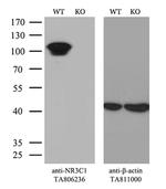 NR3C1 Antibody in Western Blot (WB)