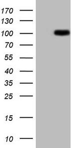 NR3C1 Antibody in Western Blot (WB)