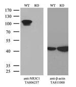 NR3C1 Antibody in Western Blot (WB)