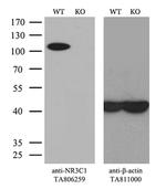 NR3C1 Antibody in Western Blot (WB)