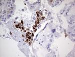 NR4A3 Antibody in Immunohistochemistry (Paraffin) (IHC (P))