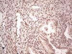 NR5A1 Antibody in Immunohistochemistry (Paraffin) (IHC (P))