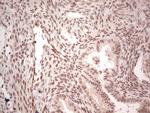 NR5A1 Antibody in Immunohistochemistry (Paraffin) (IHC (P))