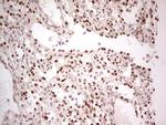 NR5A1 Antibody in Immunohistochemistry (Paraffin) (IHC (P))