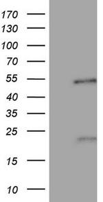 NR5A1 Antibody in Western Blot (WB)