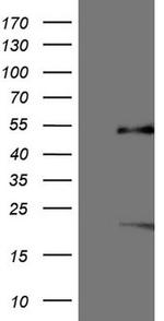 NR5A1 Antibody in Western Blot (WB)