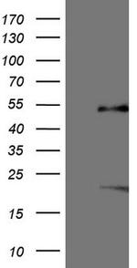 NR5A1 Antibody in Western Blot (WB)