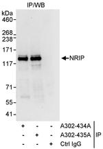 NRIP Antibody in Immunoprecipitation (IP)